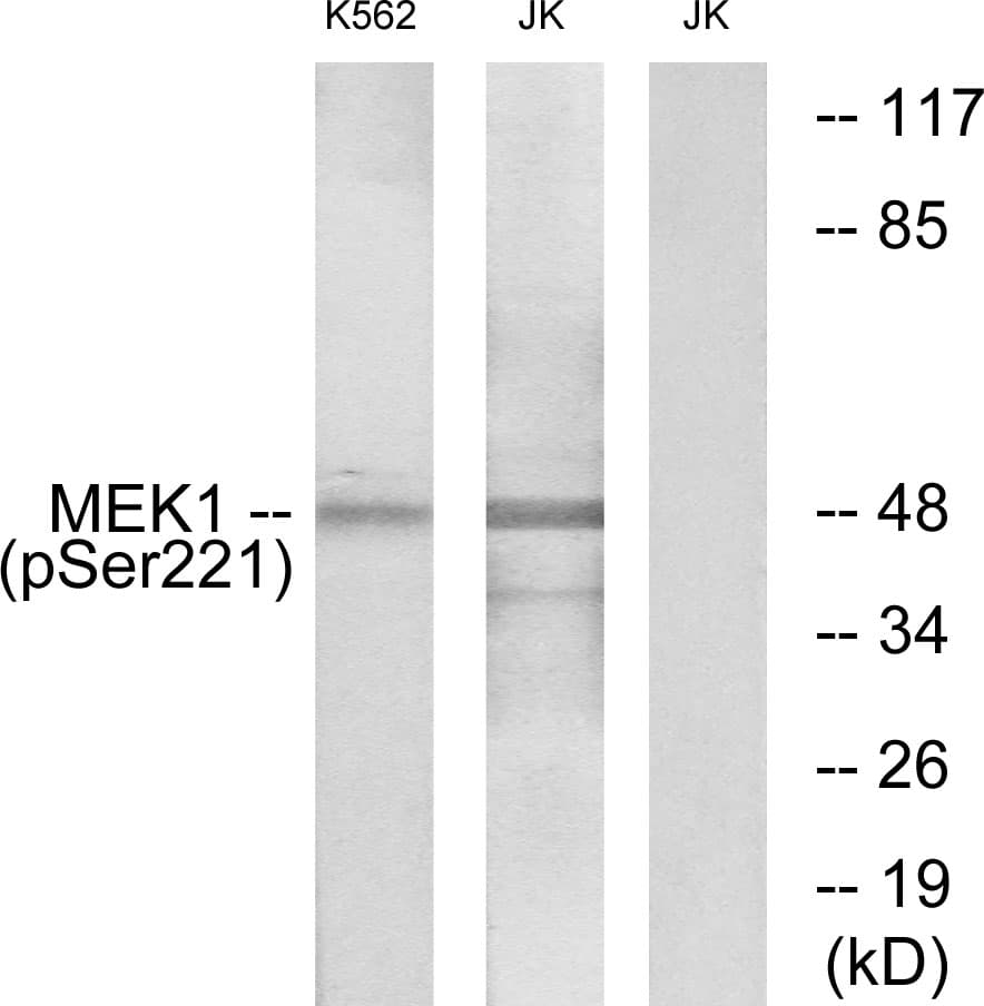 MEK1 + MEK2 Antibody (phospho-Ser221)