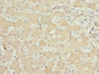 SAR1A / SAR1 Antibody