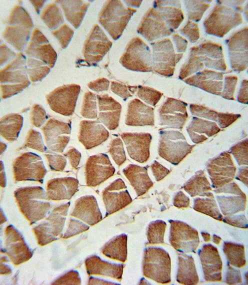 Polyclonal Rabbit anti-Human CYP2J2 Antibody (aa156-183, IHC, WB)