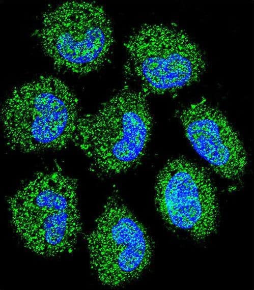 Polyclonal Rabbit anti-Human PRAMEF6 Antibody (aa395-423, IHC, IF, WB)