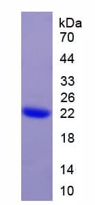 Human CRH / CRF Protein (Recombinant His)