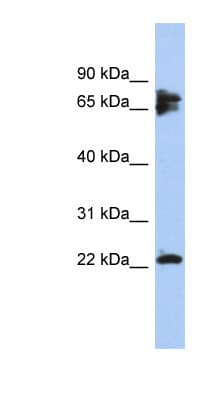 PPP3R1 / Calcineurin B Antibody (N-Terminus, FITC)