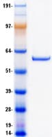 Human PGM5 / Aciculin Protein (Recombinant Myc-DDK (Flag))
