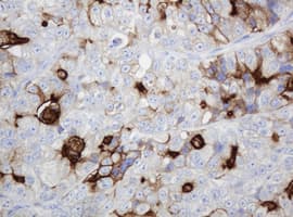 Monoclonal Mouse anti-Human ABCB1 / MDR1 / P Glycoprotein Antibody (clone OTI2C7, IHC, WB)