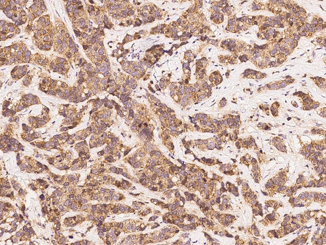 EIF4E Antibody (Preservative Free)