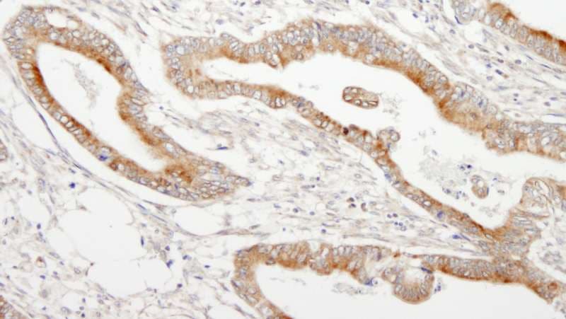 MAP7 Antibody (aa720-749)