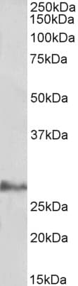 IHC-plus™ Polyclonal Goat anti-Human IL17D Antibody (IHC, WB)