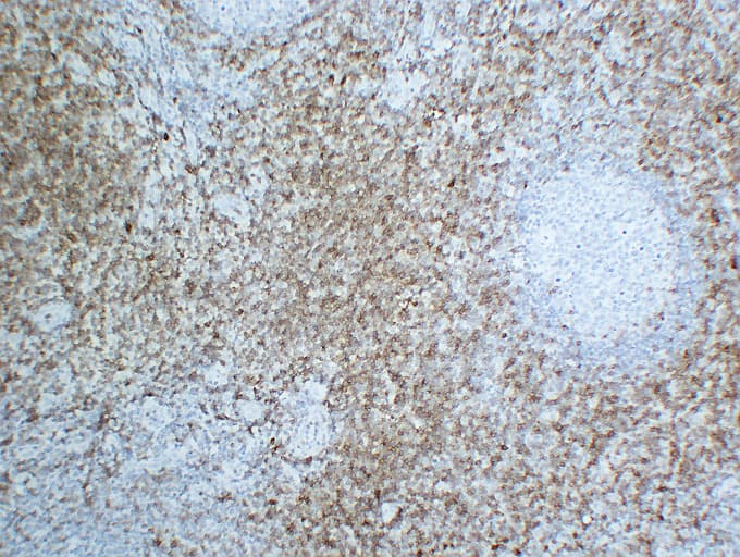Monoclonal Mouse anti-Human CD7 Antibody (clone ABT-CD7, IHC)