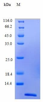 Human CCL13 / MCP4 Protein (Recombinant)
