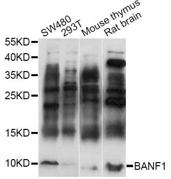 Polyclonal Rabbit anti-Human BANF1 / BAF / BCRP1 Antibody (WB)