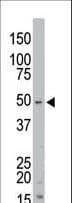 STK35 Antibody (aa374-404)