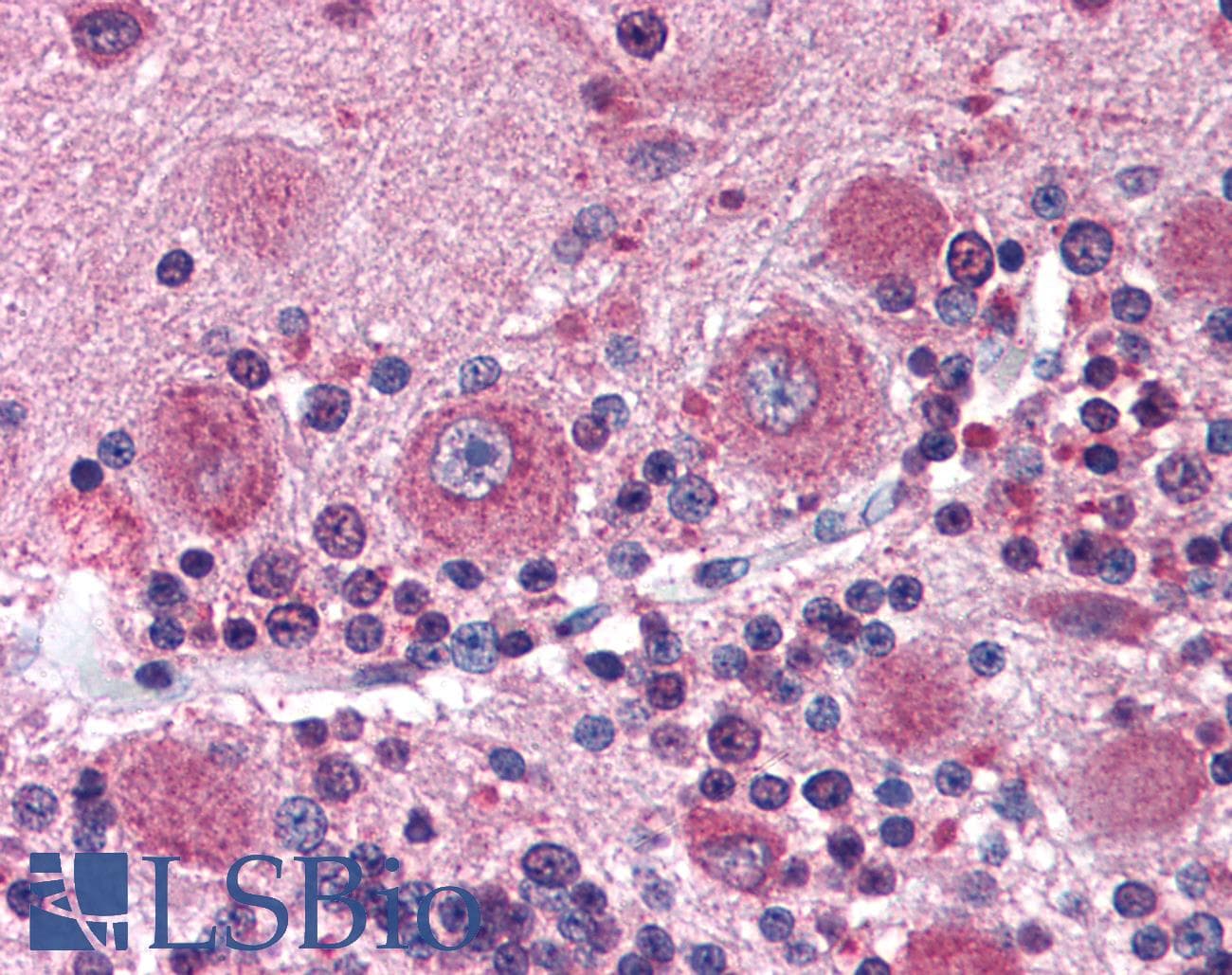 IHC-plus™ DISC1 Antibody (C-Terminus)