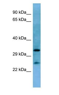 Polyclonal Rabbit anti-Mouse HOXA6 Antibody (N-Terminus, WB)