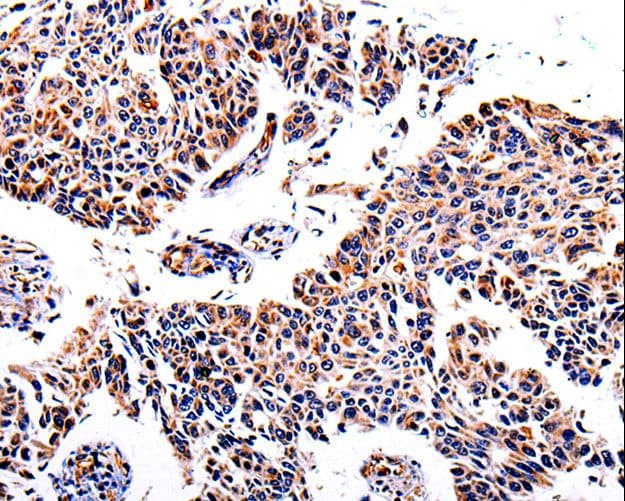 AKR1B1 / Aldose Reductase Antibody