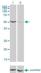 PGM1 / Phosphoglucomutase 1 Antibody (clone 3B8-H4)