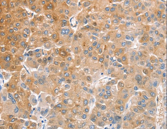 Yo / CDR2 Antibody