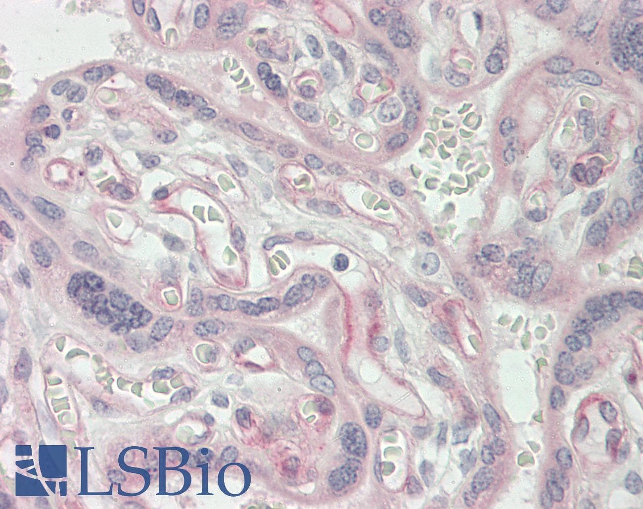 IHC-plus™ CECR1 Antibody