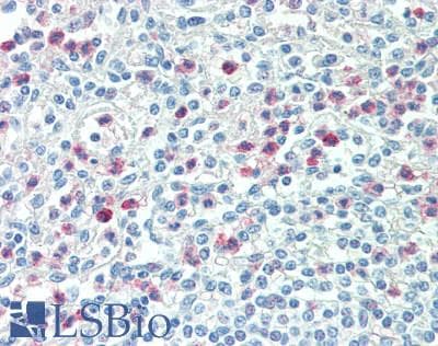 IHC-plus™ IRGM / LRG-47 Antibody