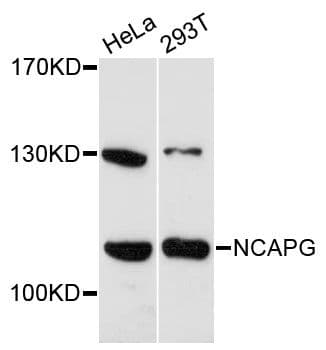 Polyclonal Rabbit anti-Human NCAPG / HCAP-G Antibody (WB)