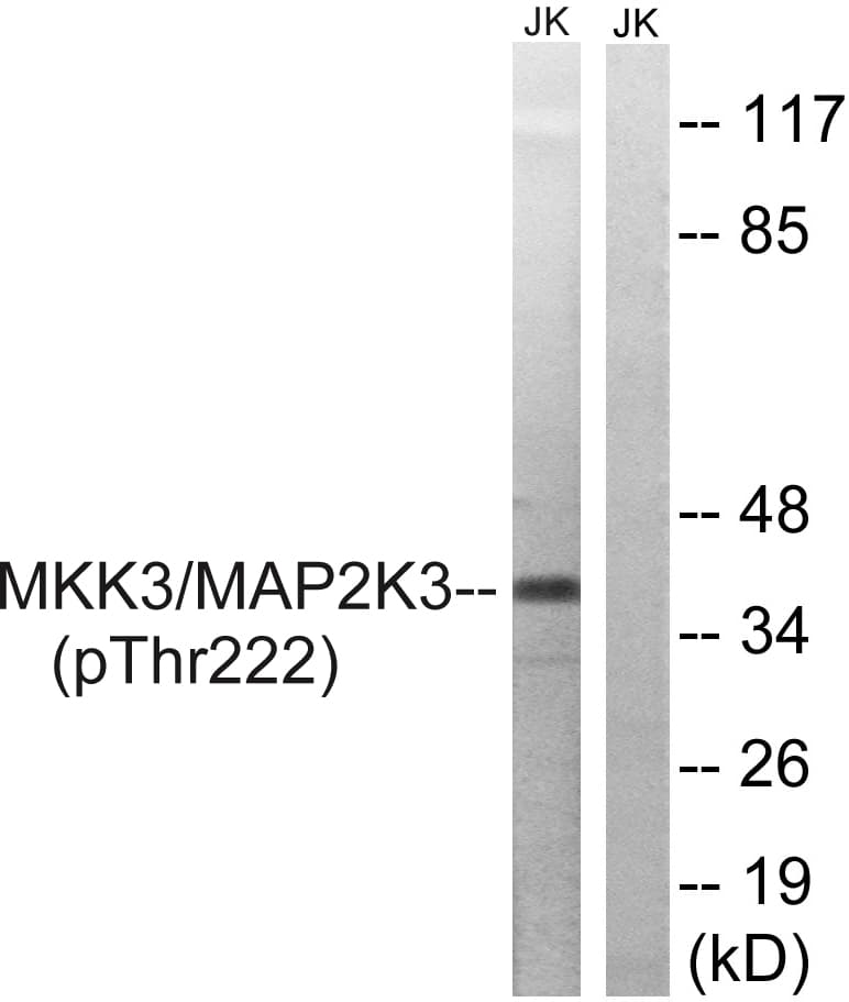 MAP2K3 / MEK3 / MKK3 Antibody (phospho-Thr222)