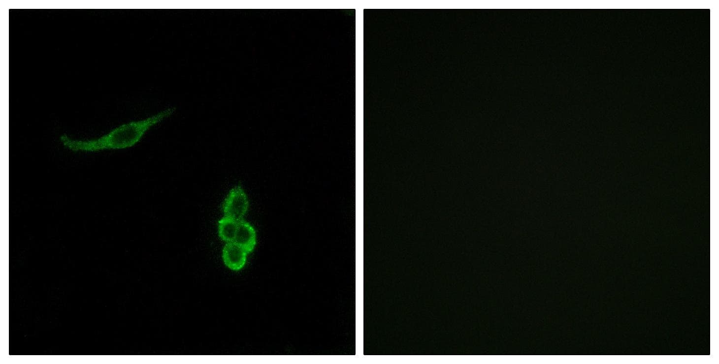 Polyclonal Rabbit anti-Human SCNN1D Antibody (IF, WB)