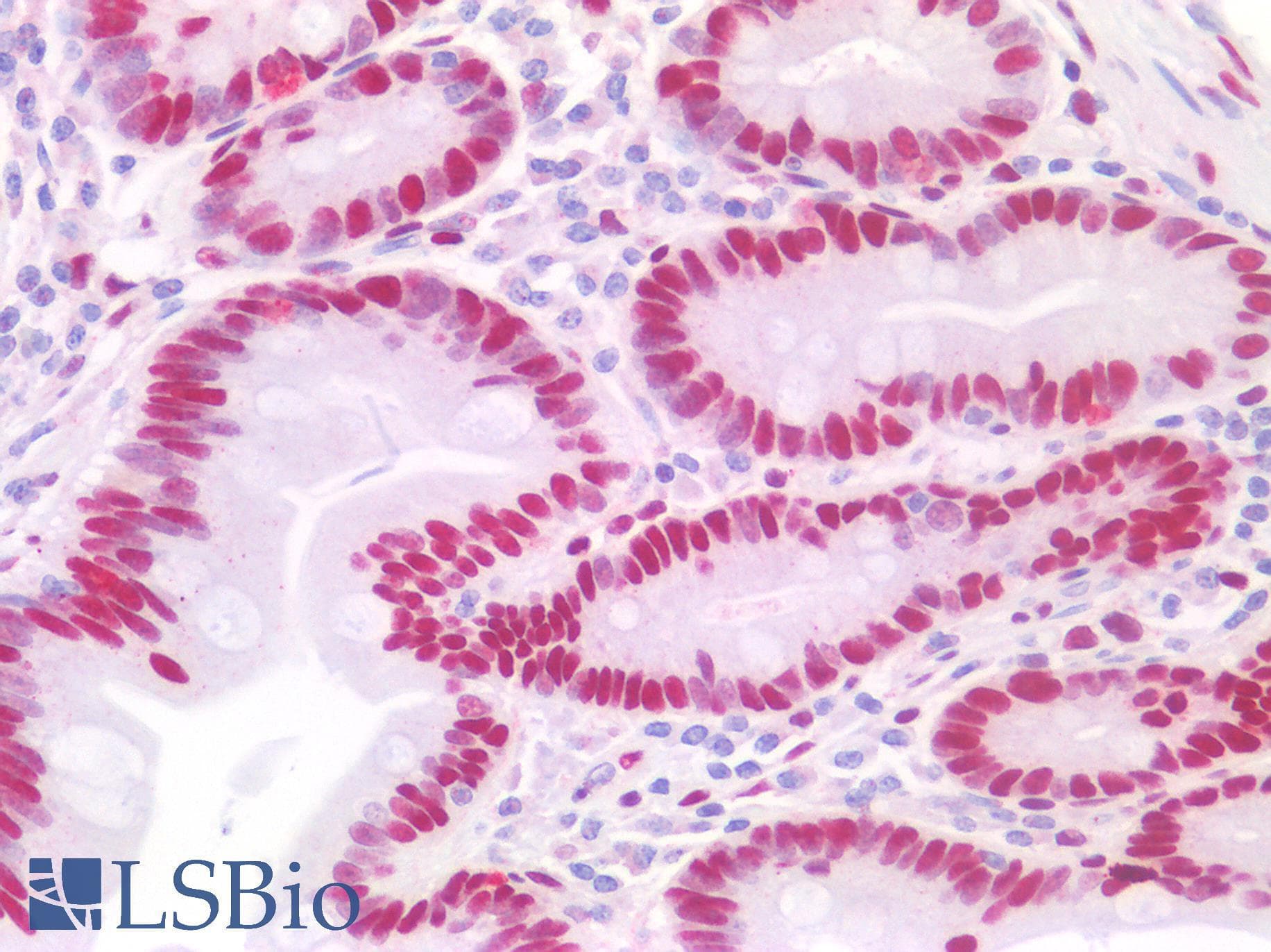 IHC-plus™ CTBP2 Antibody (C-Terminus)