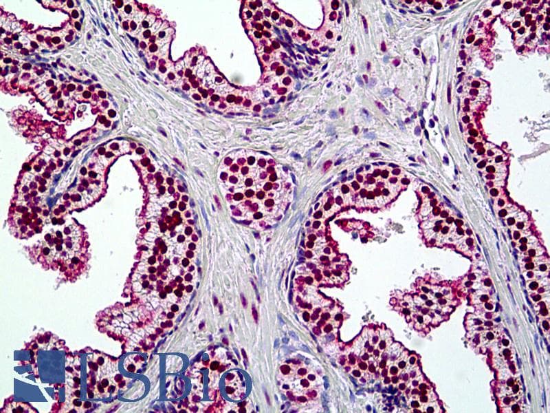 PathPlus™ SMARCA4 / BRG1 Antibody (aa2-14)