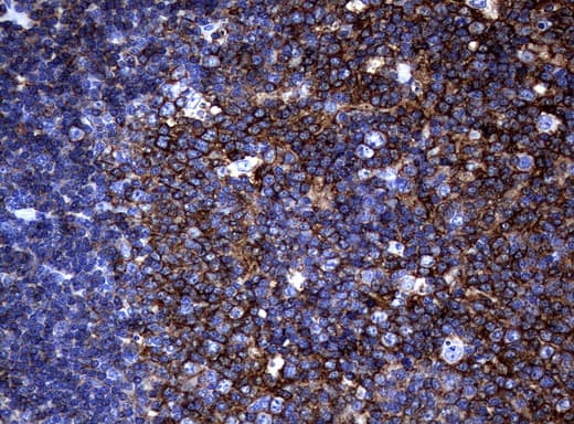CD20 Antibody (clone UMAB58, Carrier-free)