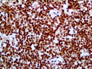 BCL10 / BCL-10 Antibody