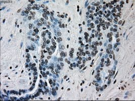 ERCC1 Antibody (clone OTI1A3)