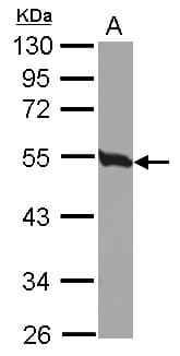TUBB4B / Tubulin Beta 4B Antibody (Internal)