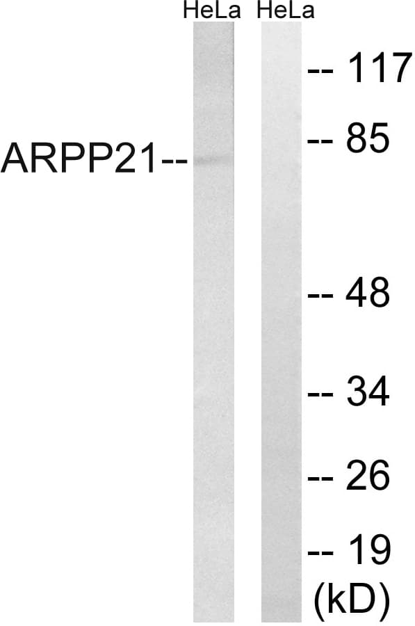 RCS / ARPP-21 Antibody (aa211-260)