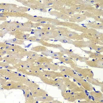 Polyclonal Rabbit anti-Human BAK1 / BAK Antibody (IHC, IF, WB)
