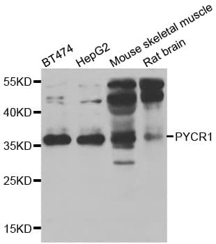 PYCR1 Antibody