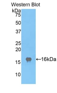 LYZ / Lysozyme Antibody (aa24-144)