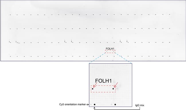 FOLH1 / PSMA Antibody (clone UMAB26)