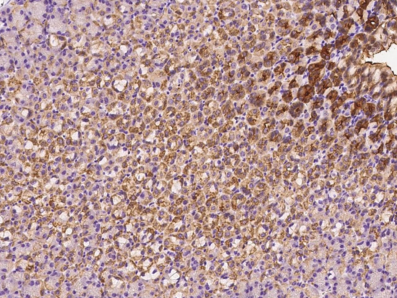 TIE1 / TIE Antibody