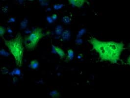 Monoclonal Mouse anti-Human MGLL / Monoacylglycerol Lipase Antibody (clone OTI1H1, IHC, IF, WB)