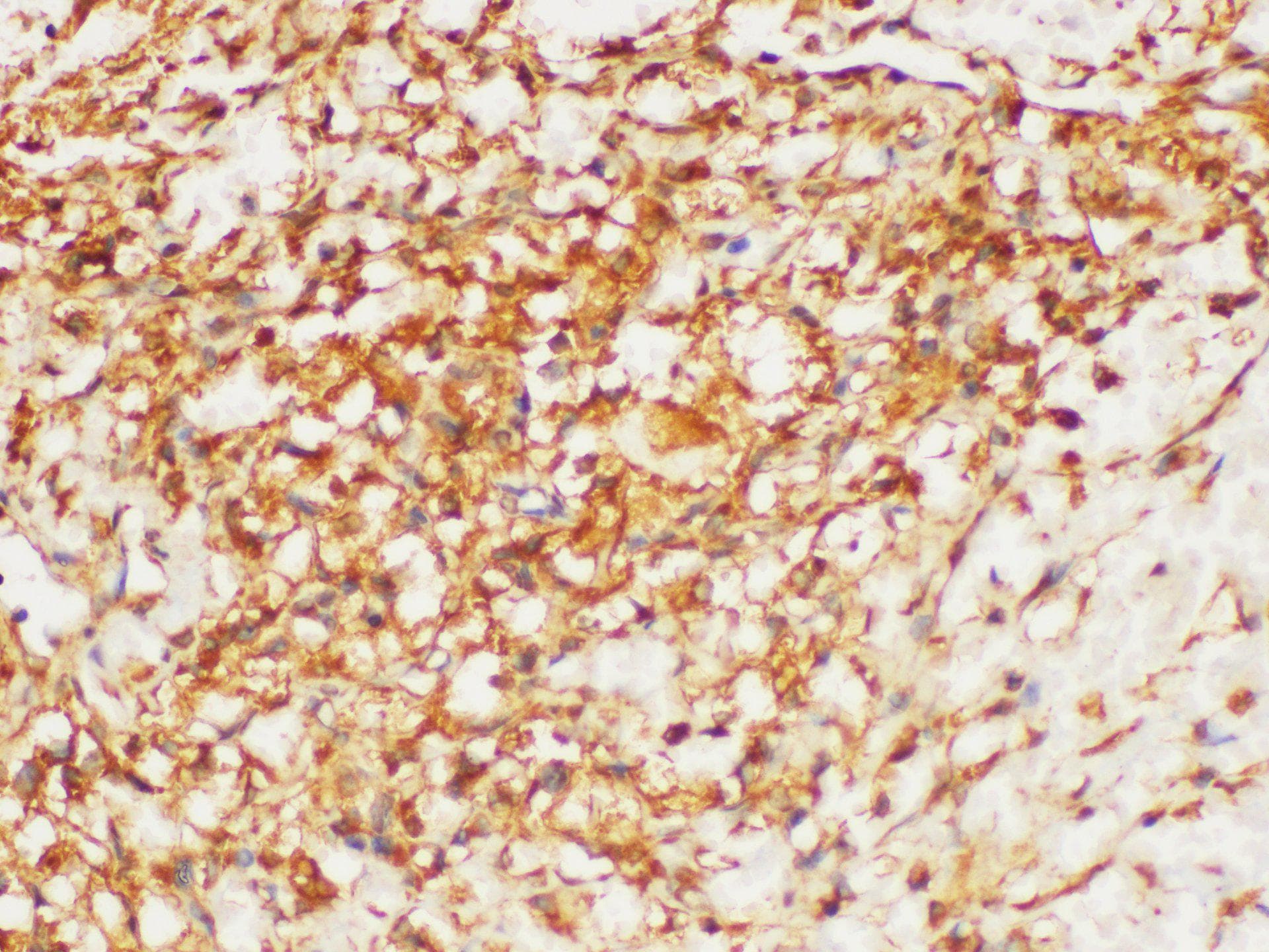 HRAS / H-Ras Antibody