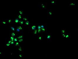 PGAM2 Antibody (clone OTI1C2)