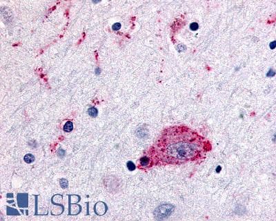 PathPlus™ CCR1 Antibody (Extracellular Domain)