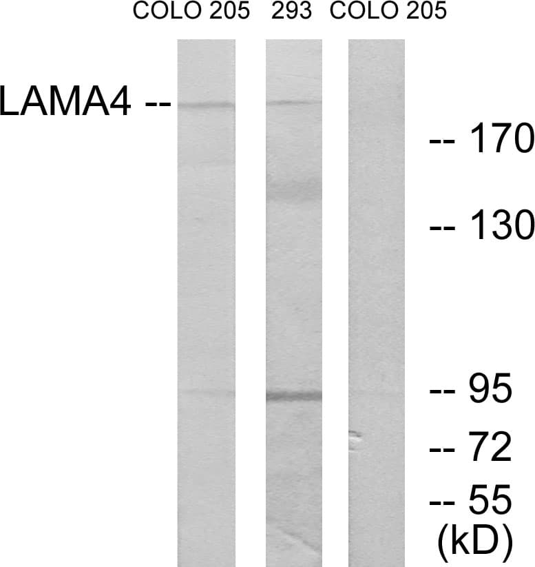 LAMA4 / Laminin Alpha 4 Antibody (aa481-530)