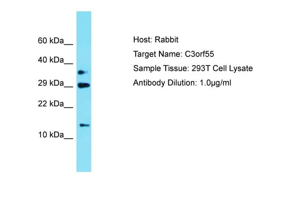 PQLC2L Antibody (N-Terminus)
