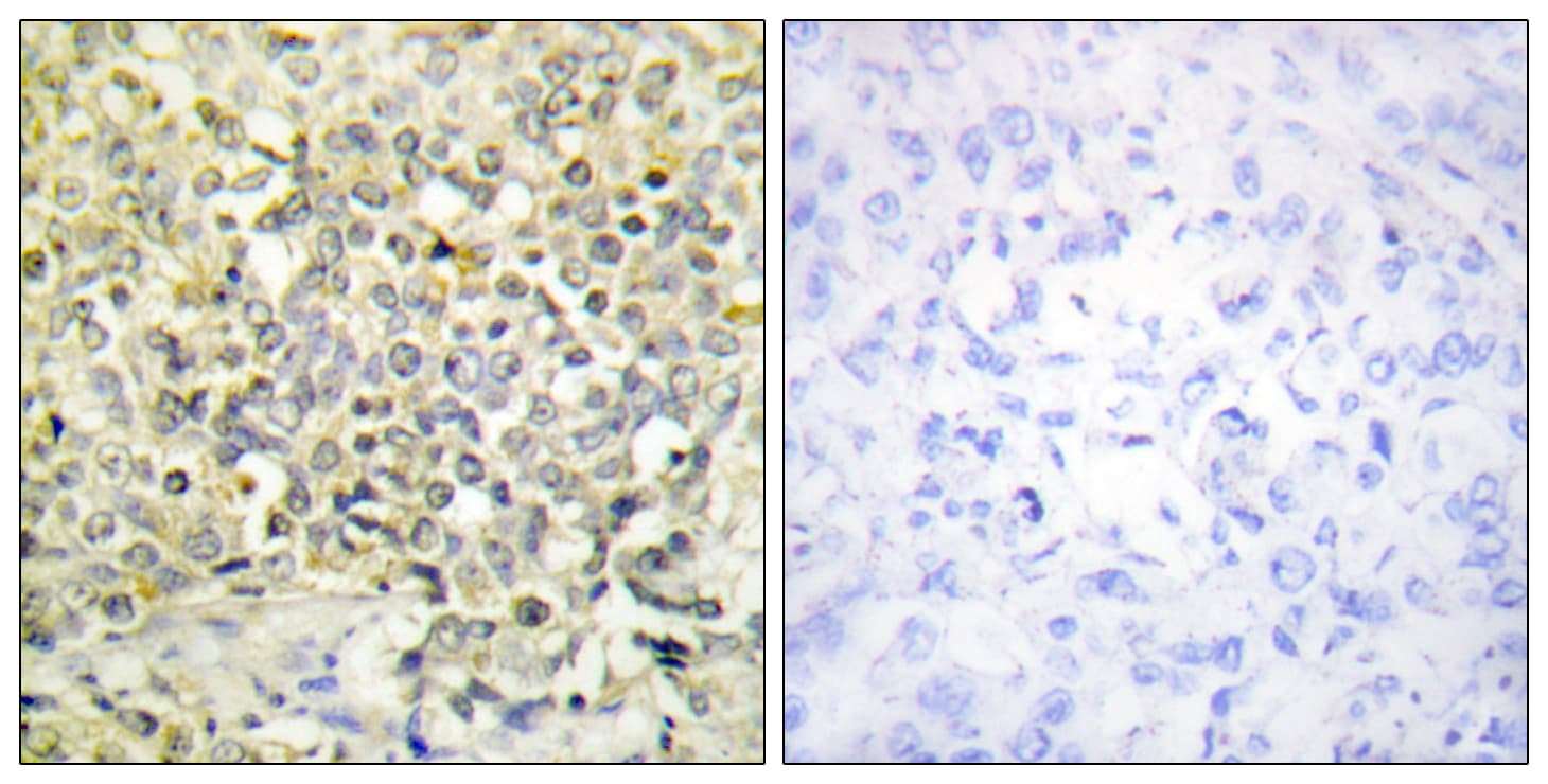 CDKL4 Antibody (aa266-315)