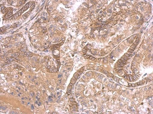 Polyclonal Rabbit anti-Human IHH Antibody (aa124-401, IHC)