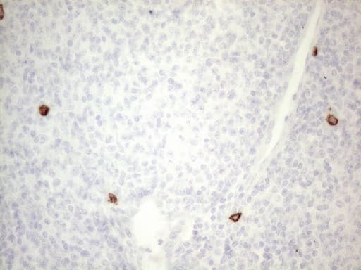 Monoclonal Mouse anti-Human c-Kit / CD117 Antibody (clone OTI2B12, aa27-308, IHC, WB)