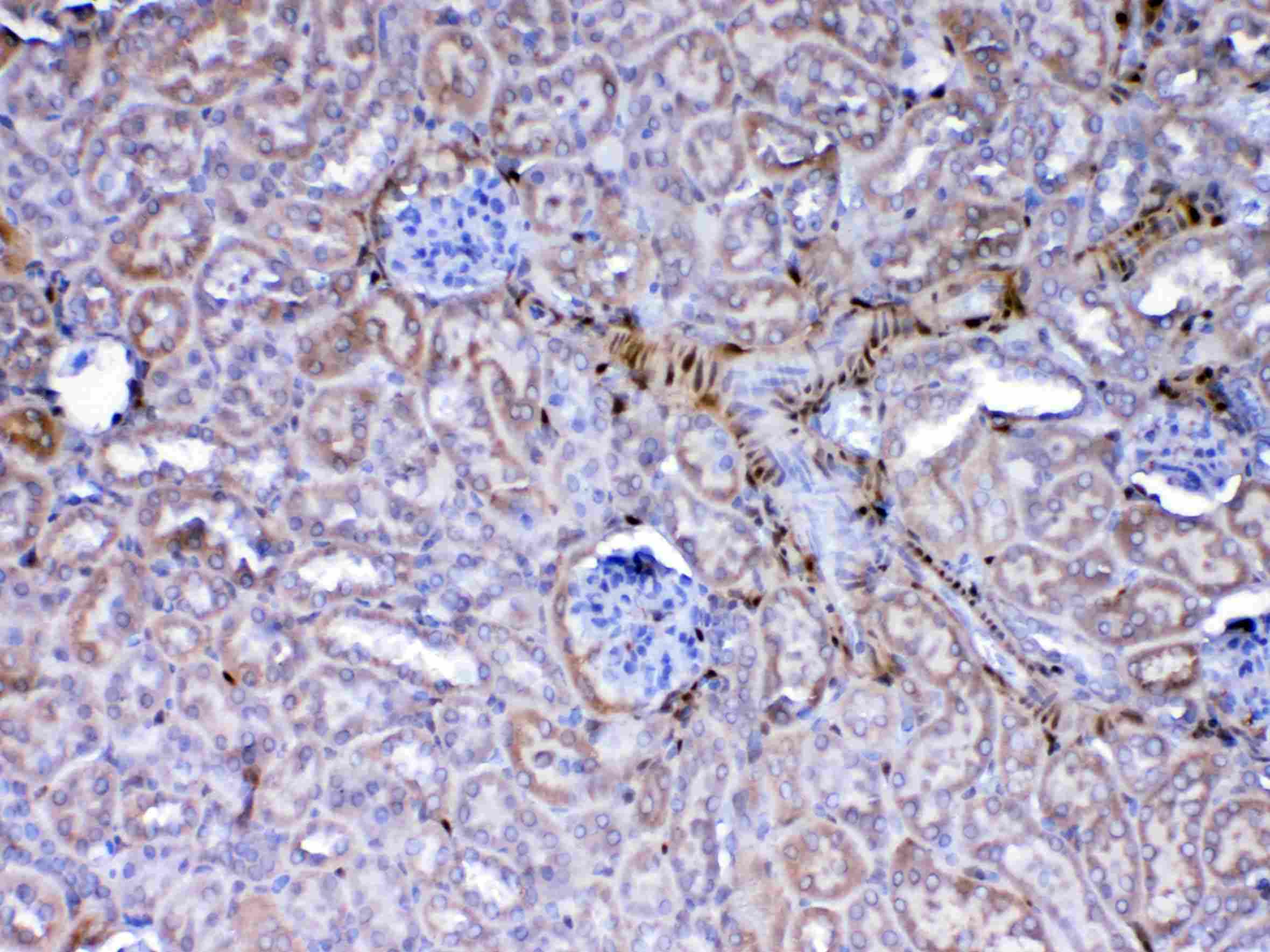 LGALS1 / Galectin 1 Antibody