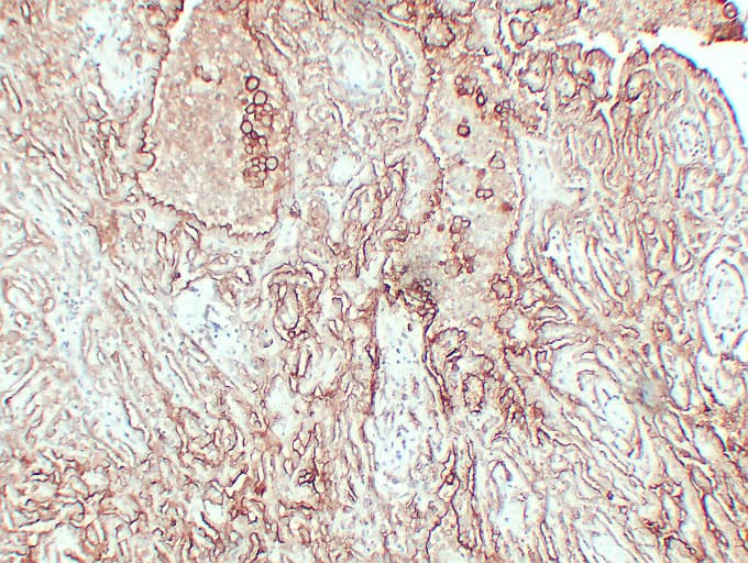 IHC-plus™ Monoclonal Mouse anti-Human MUC16 / CA125 Antibody (clone ABT-MUC16, IHC)