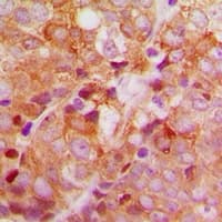 ACBD6 Antibody (Internal)