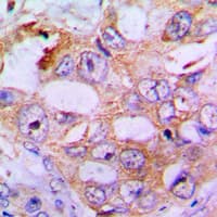 Polyclonal Rabbit anti-Human IRS1 Antibody (phospho-Ser636, IHC, IF, WB)